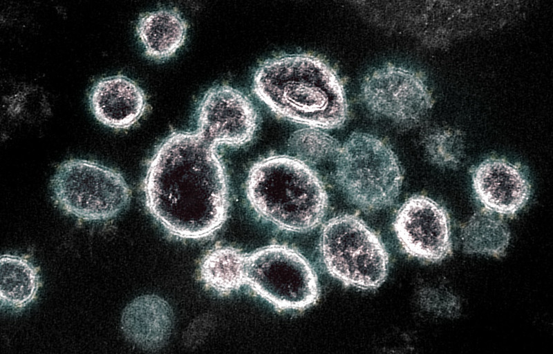 Imagen del coronavirus de microscopía electrónica